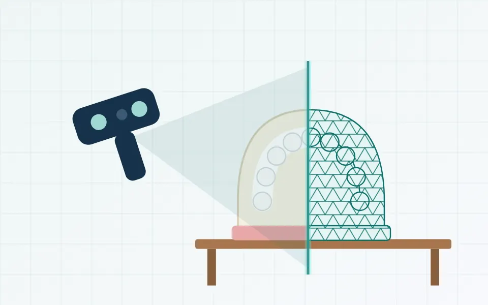 Illustration of a plaster dental model on a table being 3D scanned
